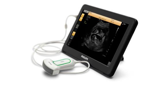 Philips launches innovative ultrasound to boost healthcare access for South African mothers