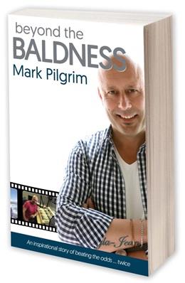 <i>Beyond the Baldness</i> is an inspirational story of beating the odds twice